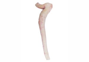 Aorta