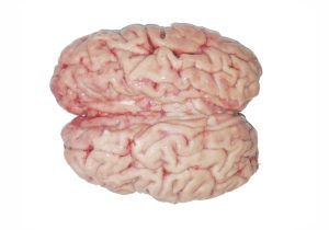 Brain