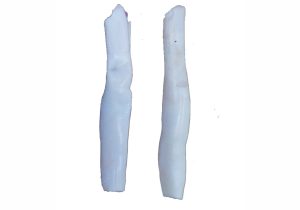 Short Tendon